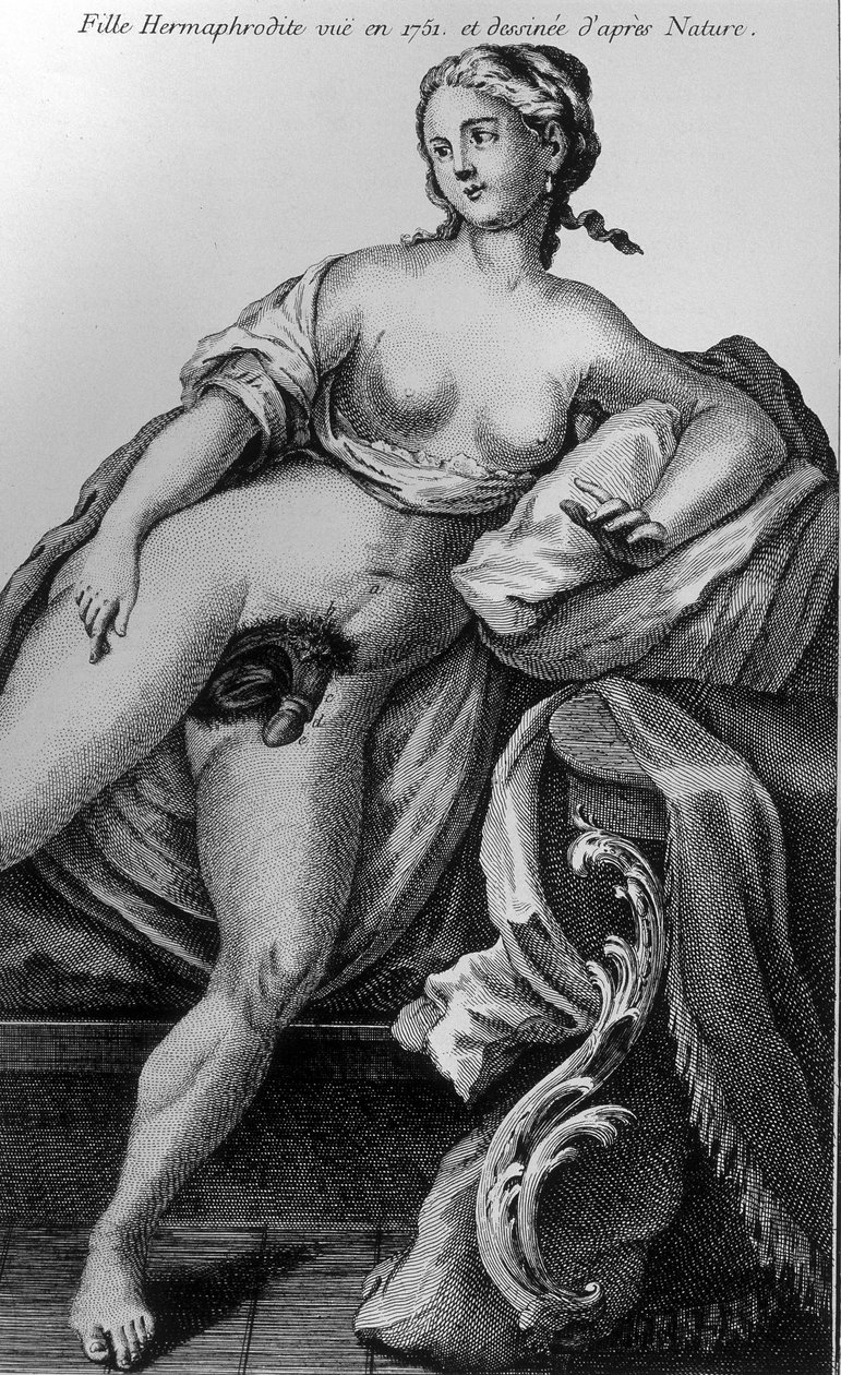 Hermafroditflicka sedd 1751 och hämtad från naturen. av Unknown artist