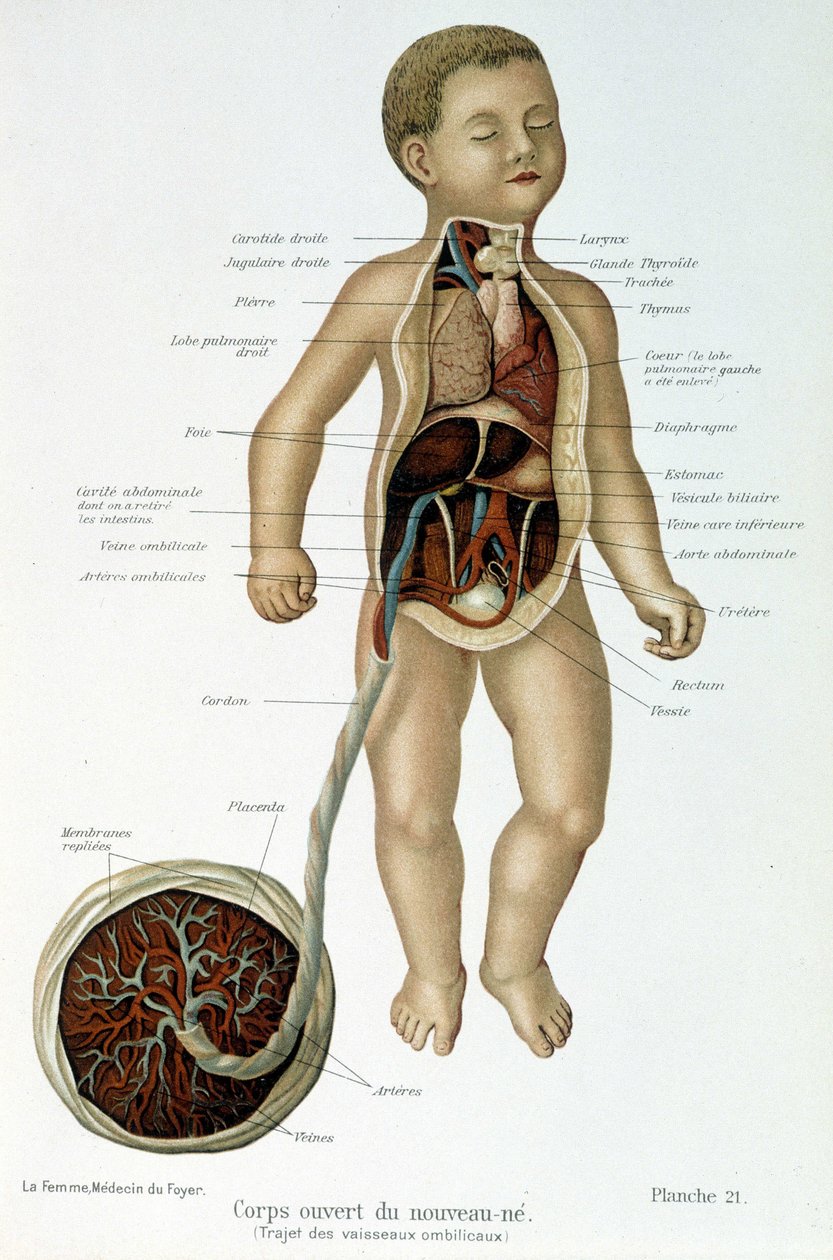 Medicin: nyfödd (flådd i bysten). av Unknown artist