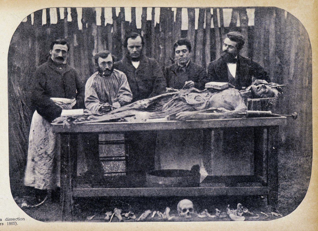 Dissektion, v.1865. av Unknown photographer