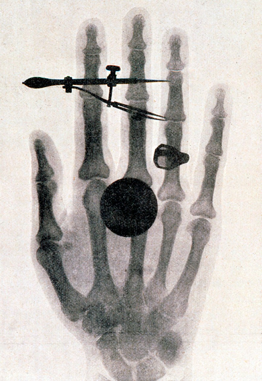Wilhelm Röntgens röntgenfotografi av sin hustrus hand, 1896 av Wilhelm Conrad Rontgen