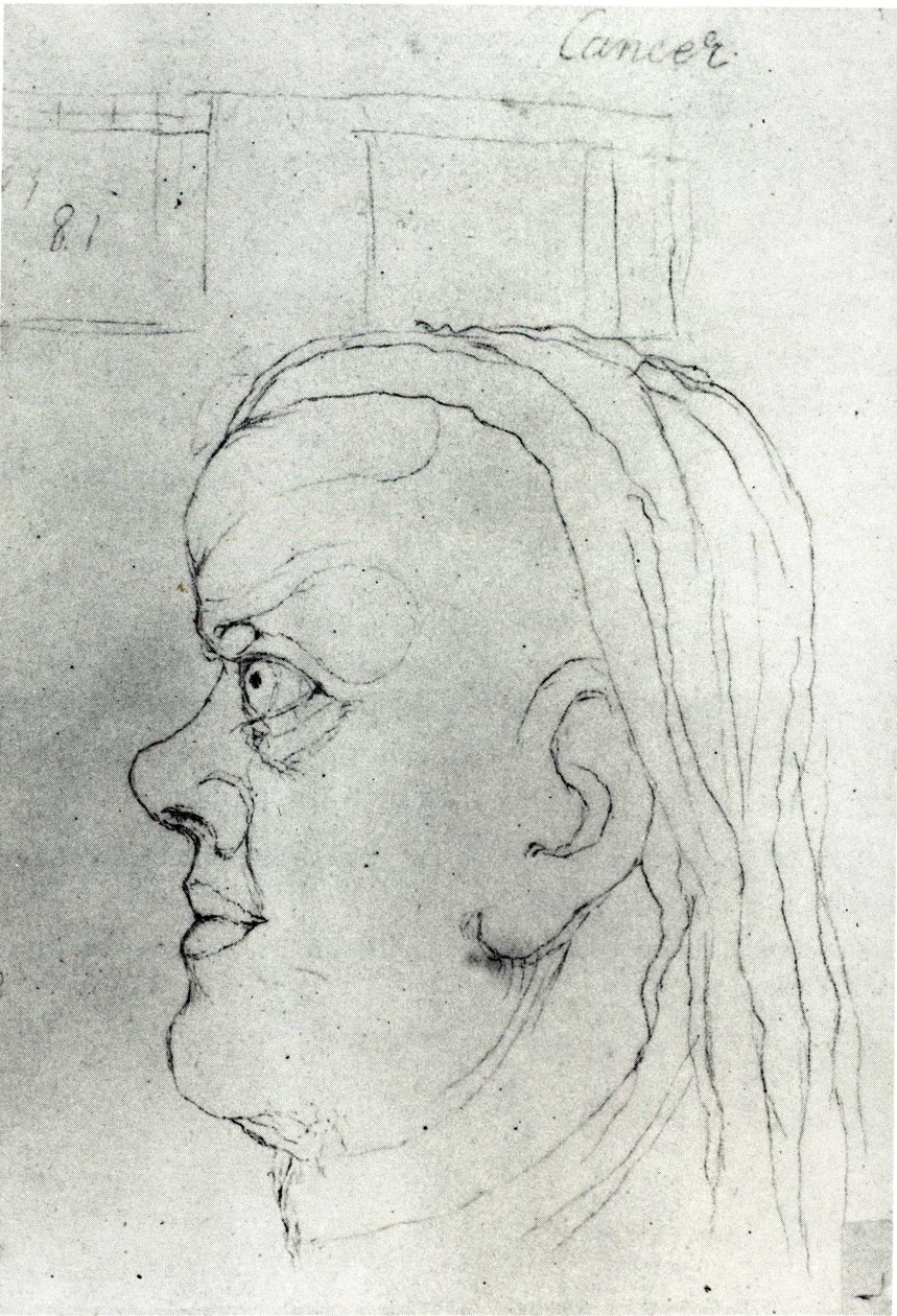 Head of Cancer  av William Blake