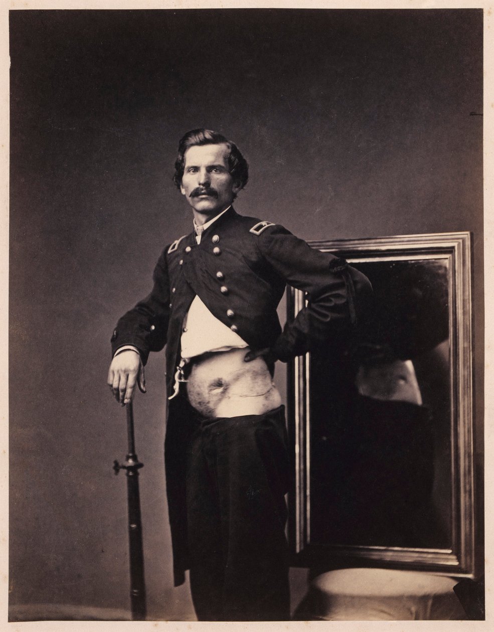 Major H. A. Barnum, tillfrisknande efter en penetrerande skottskada i buken med perforering av vänster Ilium, från den kirurgiska avdelningens fotokatalog av William Bell