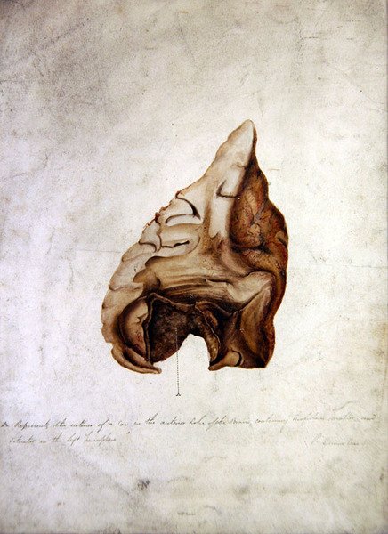 Studie av hjärna I, ca 1850 (akvarell på papper) av William Lover