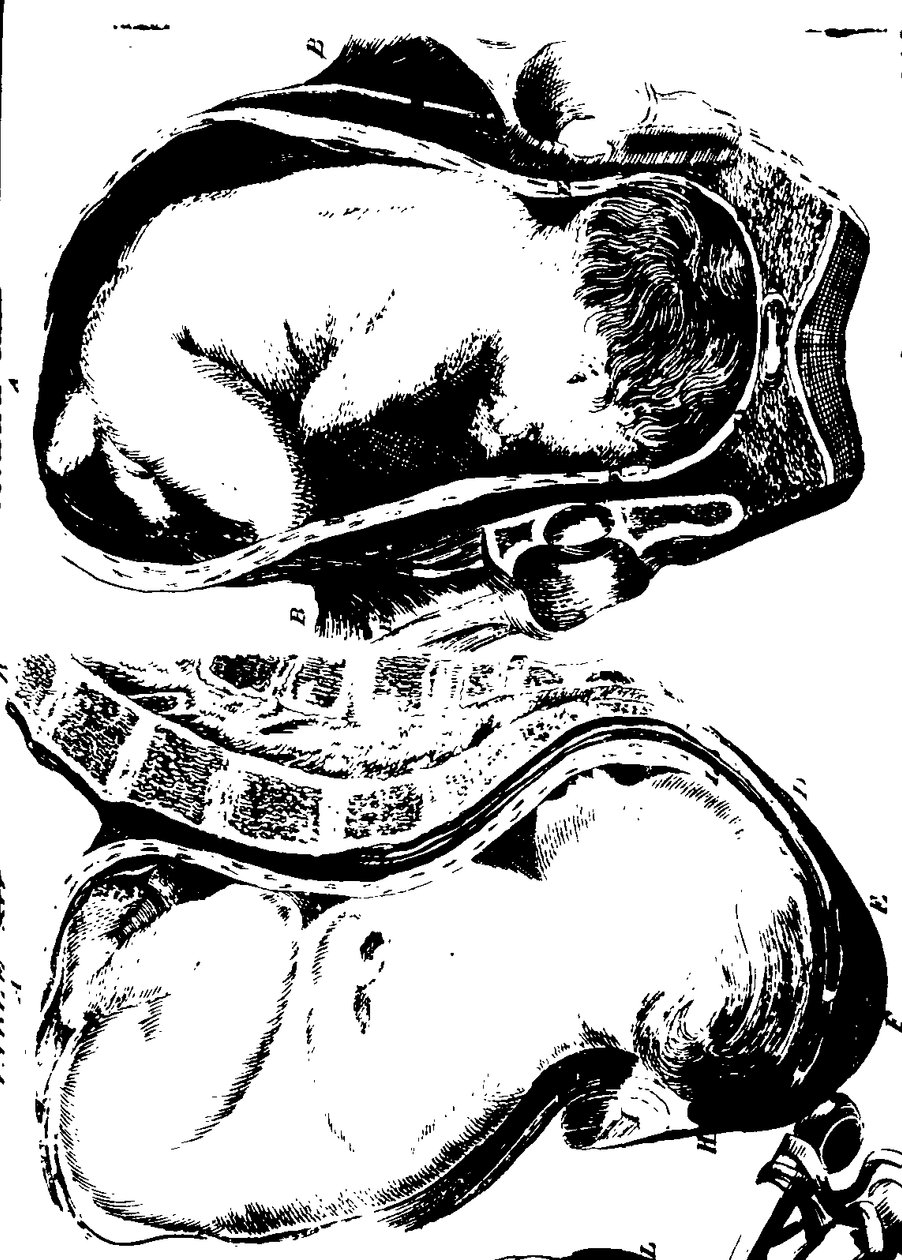Fleuron from book:  A treatise on the theory and practice of midwifery.  av William Smellie