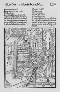 The Book of Cirurgia av Hieronymus Brunschwig (litho)