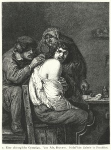 Ryggoperationen av Adriaen (after) Brouwer