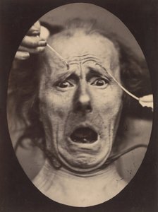 Electro-Physiologie, figur 64, 1854-56, tryckt 1862.