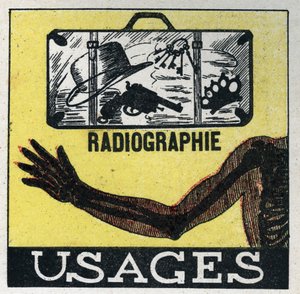 Röntgen: användning av röntgen för att se igenom föremål och kroppar. Anonym illustration från 1925. Privat samling. av Anonymous Anonymous