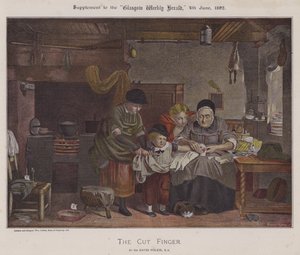 The Cut Finger (färg litho)