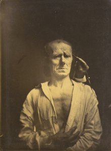 Spasm av m. corrugator supercilii under mycket starkt ljus kvar, Ett avslappnat ansikte..., 1854-1855.