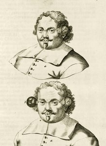 Ett exempel på koppning, från The Practice of Medicine av Frederik Dekkers, 1694 av Dutch School