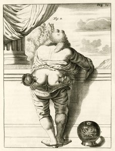 Ett exempel på koppning, från The Practice of Medicine av Frederik Dekkers, 1694 av Dutch School