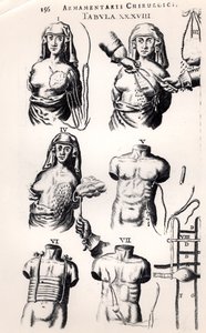 Opererar på bröstcancer, från Armamentarii Chirurgici av Johannes Schultes (1595-1645) publicerad i Amsterdam, 1672 av Dutch School