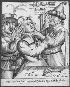 Trepanning, graverad av H. Weydmans (1500-talet) av Dutch School