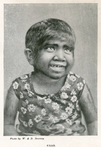 Krao, The Missing Link, utställd på Aquarium, Westminster, London, 1887 av English Photographer