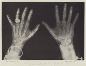 Royal Hands reproducerad av Rontgen Rays (gravyr) av English School