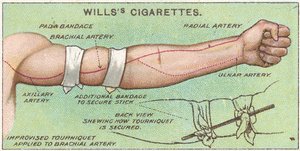 Tourniquet, nr 11 från First Aid-serien med Willss Cigarettes-kort, 1913 av English School
