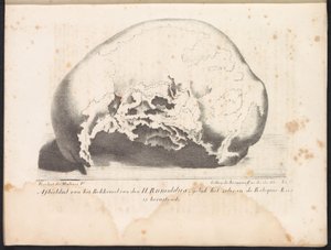 Skull of Saint Rombout, 1825 Bild på Bekkeneel van den H. Rumoldus som den ligger i Reliquie-Kas (titel på objektet)