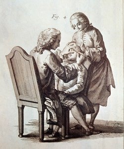 En läkare som opererar en patient med grå starr, illustration från Medical Encyclopedia av Denis Diderot och Jean le Rond d