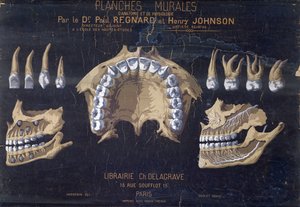 Anatomisk väggkarta över tänderna av French School