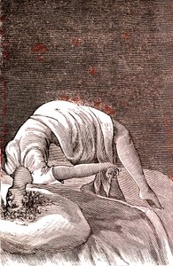 Hysteri, psykisk och nervös störning, som härrör från intensiv ångest. 1887 (gravyr) av French School