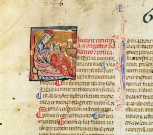 Ms Lat. 7134 fol.1 Trepanation, från Kirurgi av Maitre Rolandi av French School