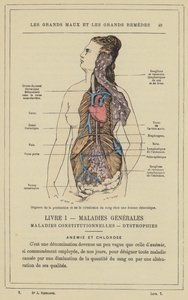 Organ för blodproduktion och cirkulation hos en klorotisk kvinna (färg litho) av French School