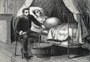 Patient med avancerad levercirrhos, läkare som utför en punktering (gravyr) 1888 av French School