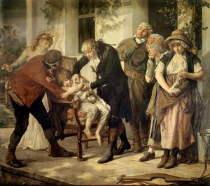 Den första vaccinationen av Edward Jenner (1749-1823), brittisk läkare som upptäckte vaccinet mot smittkoppor Målning av Gaston Melingue (1840-1914) 1796 Paris, medicinakademin