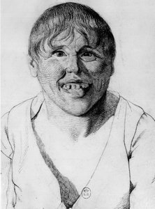 Cretine, -i ""Study of the physiognomy of aliens"", teckning av Gabriel