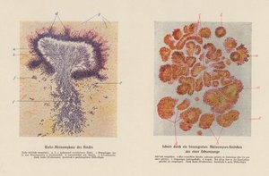 Actinomyces bovis (färglitografi) av German School