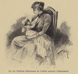 Felaktig position av ett barn under amning av German School