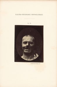 Fotografisk elektrofysiologi, figur 53 av Guillaume Benjamin Duchenne