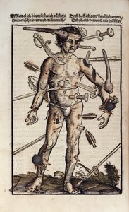 XVIIIv The Wound Man, från 