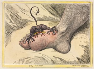 Gikten av James Gillray