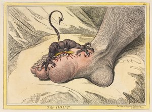 Gikten, 1799. av James Gillray
