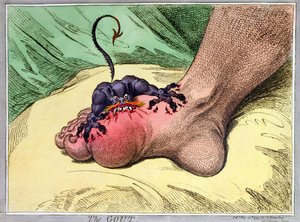 The Gout, publicerad av Hannah Humphrey 1799 (handkolorerad etsning med mjuk botten)