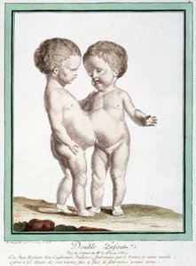 Siamesiska barn - i "" Naturens avvikelser"" av Régnault av Jean Baptiste Regnault