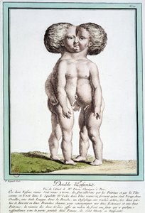 Siamesiska barn - i "" Naturens avvikelser"" av Régnault av Jean Baptiste Regnault