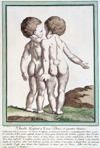 Siamesiska barn - i "" Naturens avvikelser"" av Régnault av Jean Baptiste Regnault