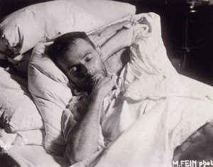 Egon Schiele på sin dödsbädd, 1918. av Martha Fein