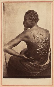 Den plågade ryggen,ca. 1863 (foto) av McPherson & Oliver