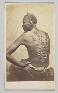 Gordon under medicinsk inspektion, 1863. av McPherson and Oliver
