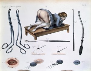 En operation på en vesikovaginal fistel, tallrik från 