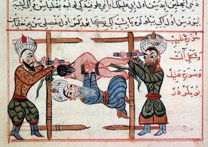 Minskning av en fraktur. Miniatyr från en behandling av turkisk medicin av Sharaf al-din av Ottoman School