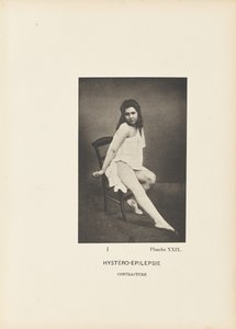 Hystero-epilepsi Kontraktur av Paul Marie Léon Regnard