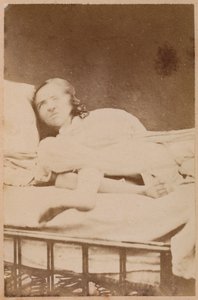 Hysterisk epilepsi, förvrängningar, plåt XXXVIII från 