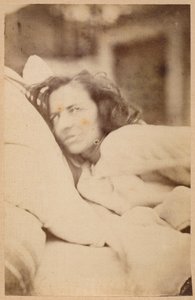Hysterisk epilepsi, delirium, lust, platta XXXVI från "Iconographie Photographique de La Salpetriere" av Bourneville et P. Regnard, Paris, 1876 (albumenprint)