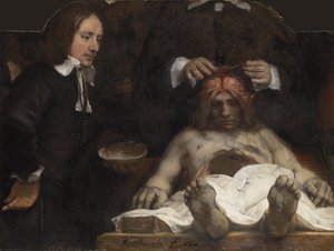 Dr Jan Deymans anatomilektion, 1656 av Rembrandt van Rijn
