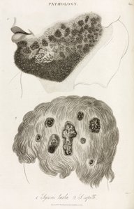 Dermatologi Hudsjukdomar av John Pardon